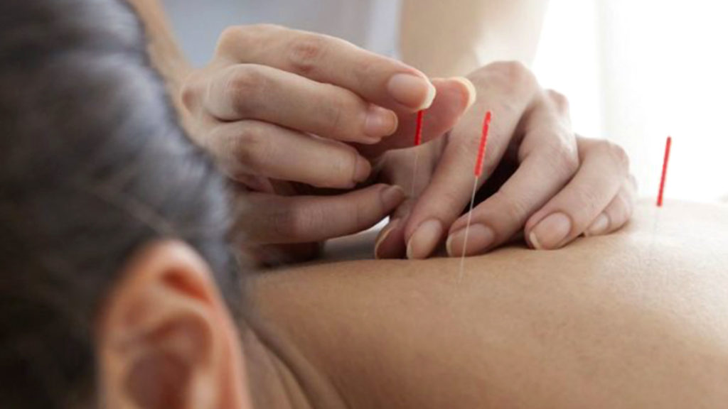 Tarek William Saab - beneficios de la acupuntura